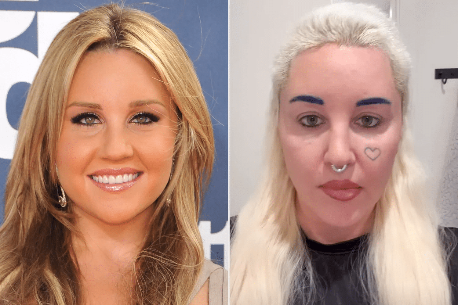 VIDEO: Amanda Bynes odhaluje: Chirurgie, která jí změnila život a vzhled! –  2. stránka – WN24.cz – World News 24